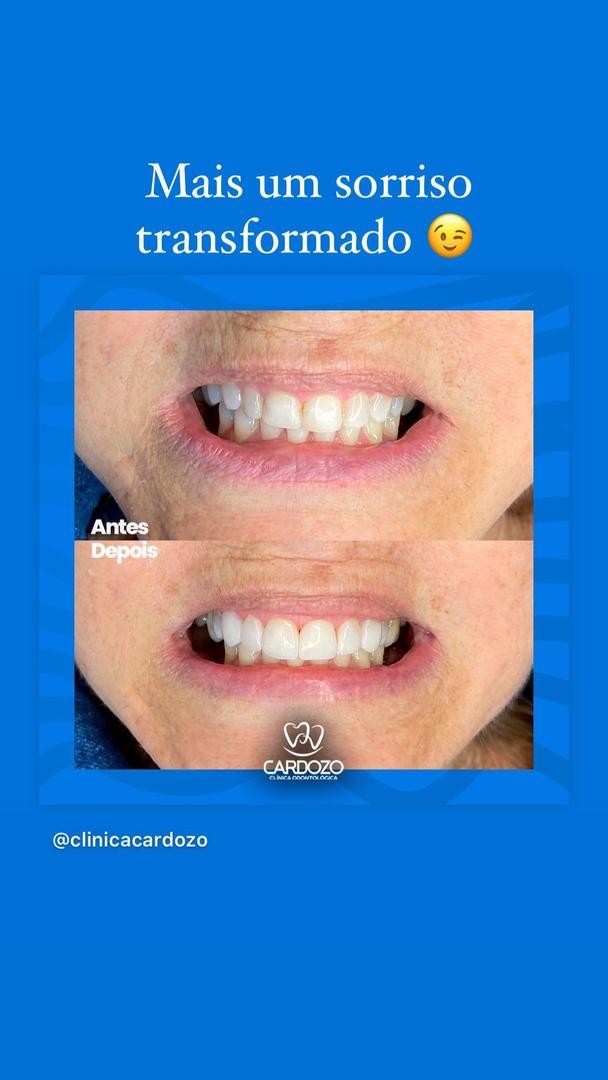 Mais um sorriso transformado